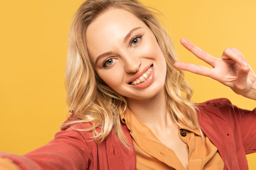 Smiling woman with dental braces showing peace sign while taking selfie isolated with yellow background.