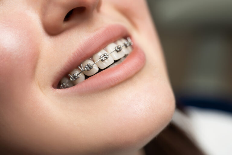 Teen with braces in Danbury, CT smiling in the orthodontists’ chair