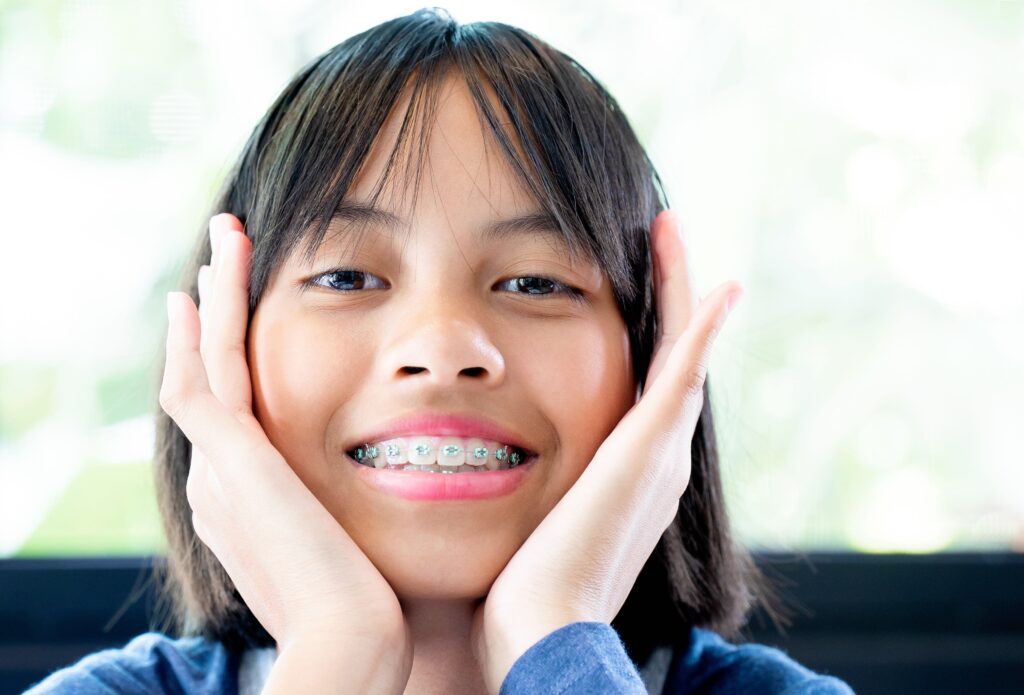 Tween receiving early orthodontic treatment with cerulean braces