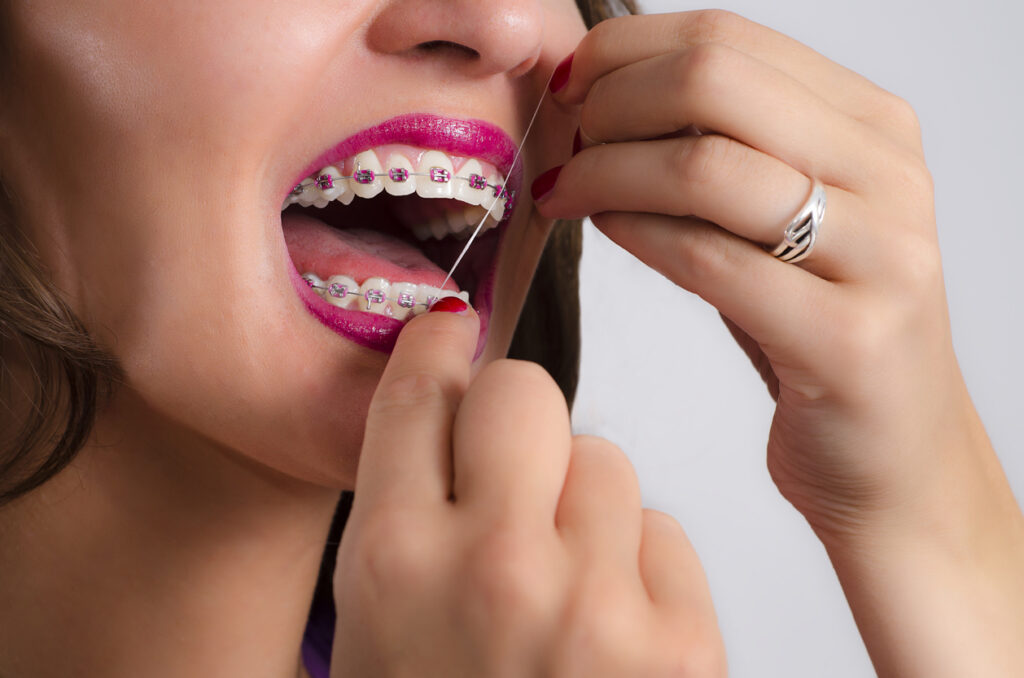 Young Woman With Braces Flossing Teeth